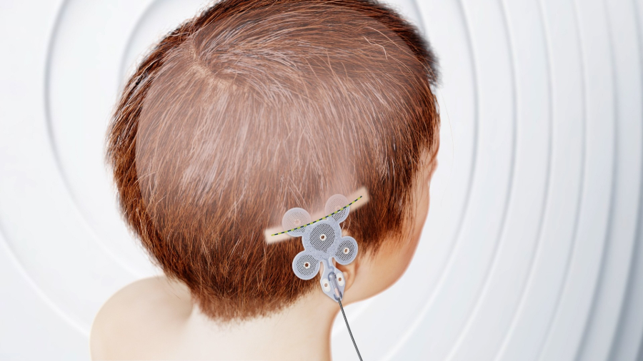 World Brain Day (July 22nd ) – NHS neurosurgeon reveals the five things everyone with Epilepsy should know about their brain